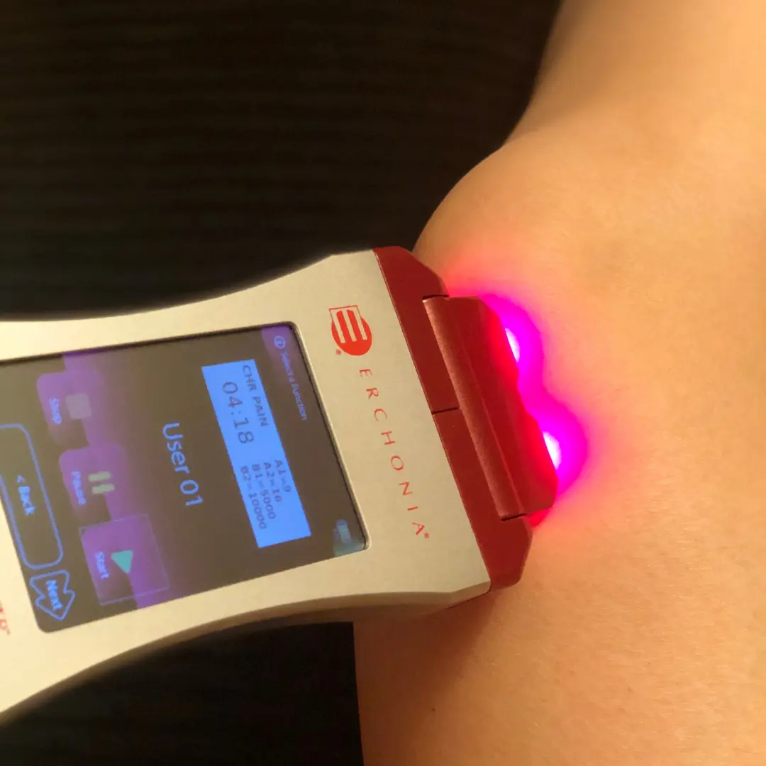 cold laser therapy