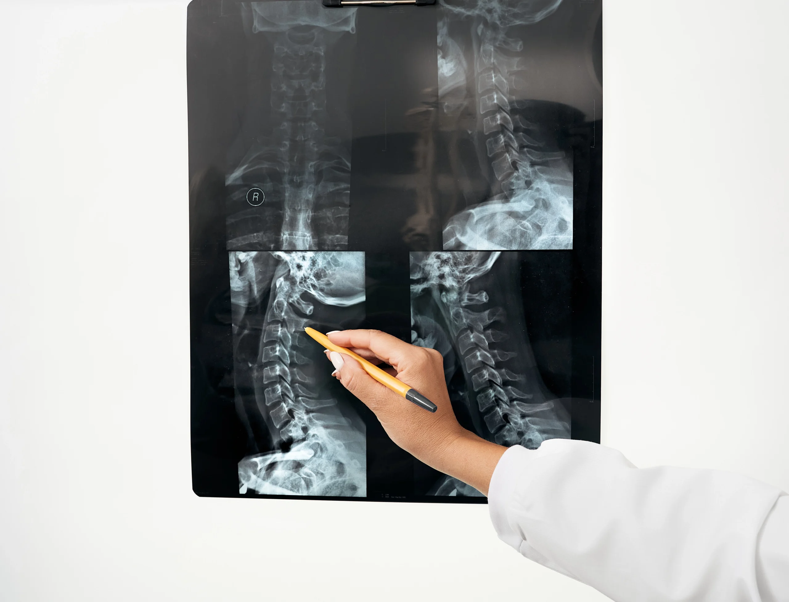 chiropractor reviews patients x-rays